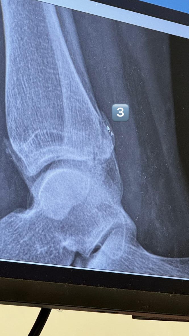Above: my 3 breaks