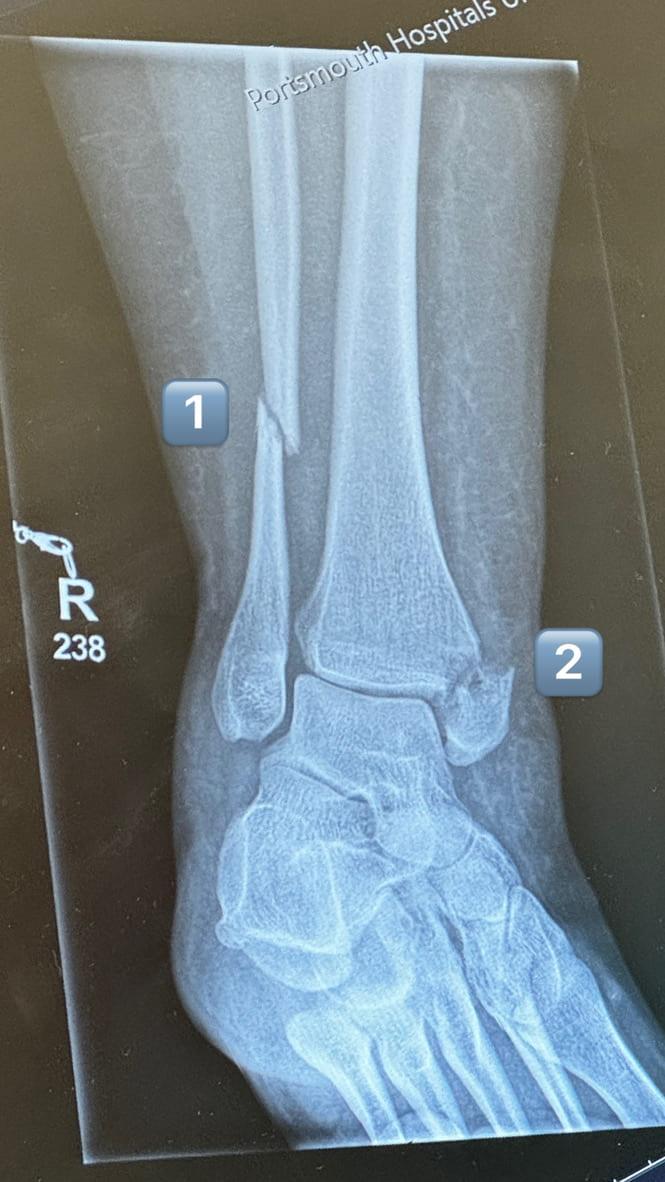 Above: my 3 breaks