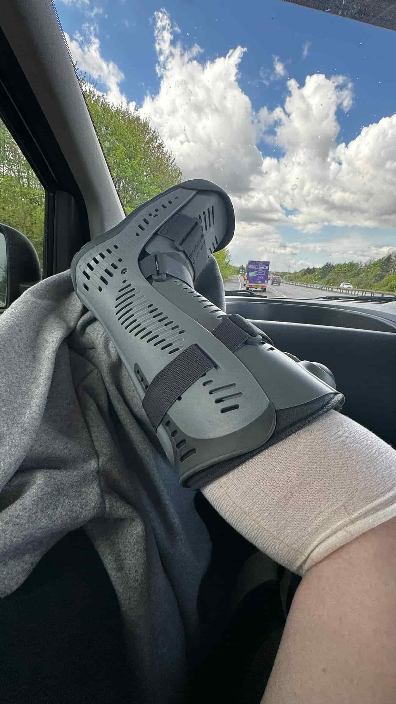 the journey up to Manchester in a very small front seat with a leg that needed elevating!